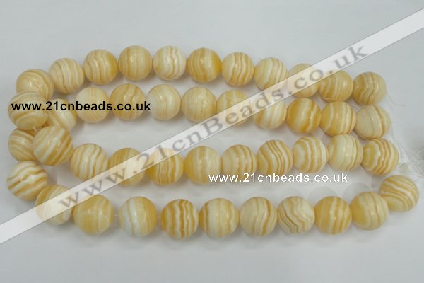 CCA206 15.5 inches 18mm round yellow lace calcite beads