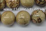 CLD51 15.5 inches 18mm round African leopard skin jasper beads