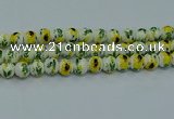 CPB735 15.5 inches 14mm round Painted porcelain beads