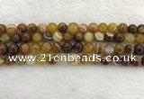 CAA1862 15.5 inches 8mm round banded agate gemstone beads