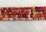 CAA1911 15.5 inches 6mm round banded agate gemstone beads