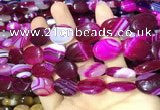 CAA2173 15.5 inches 15*20mm oval banded agate beads wholesale