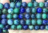 CAZ48 15 inches 10mm round azurite malachite beads wholesale
