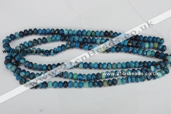 CCO170 15.5 inches 5*8mm rondelle dyed natural chrysotine beads