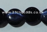 CCT528 15 inches 10mm flat round cats eye beads wholesale