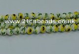 CPB732 15.5 inches 8mm round Painted porcelain beads