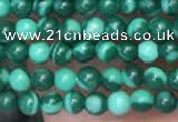 CTG2088 15 inches 2mm,3mm imitate malachite gemstone beads